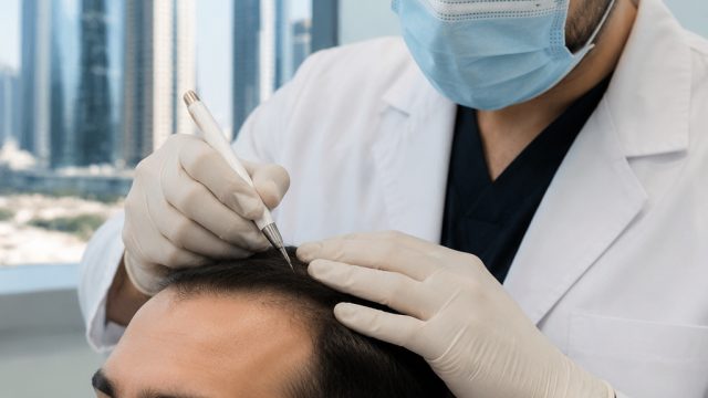Exploring Innovative Hair Restoration Methods in Dubai
