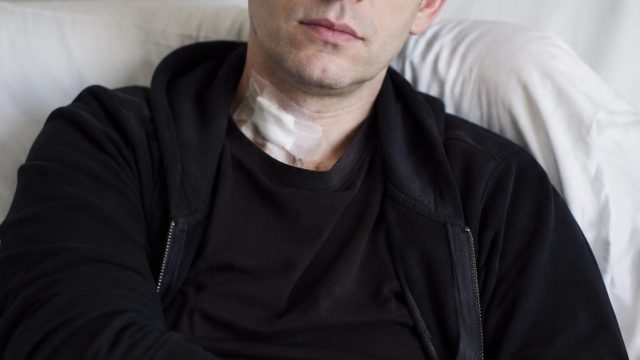 Actor Moshe Kasher Shares Recovery Journey After Cancer Surgery
